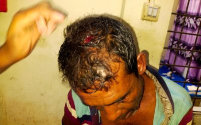 কৃষক দম্পতির উপর প্রতিপক্ষের হামলা, উদ্ধার করে হাসপাতালে পাঠাল পুলিশ
