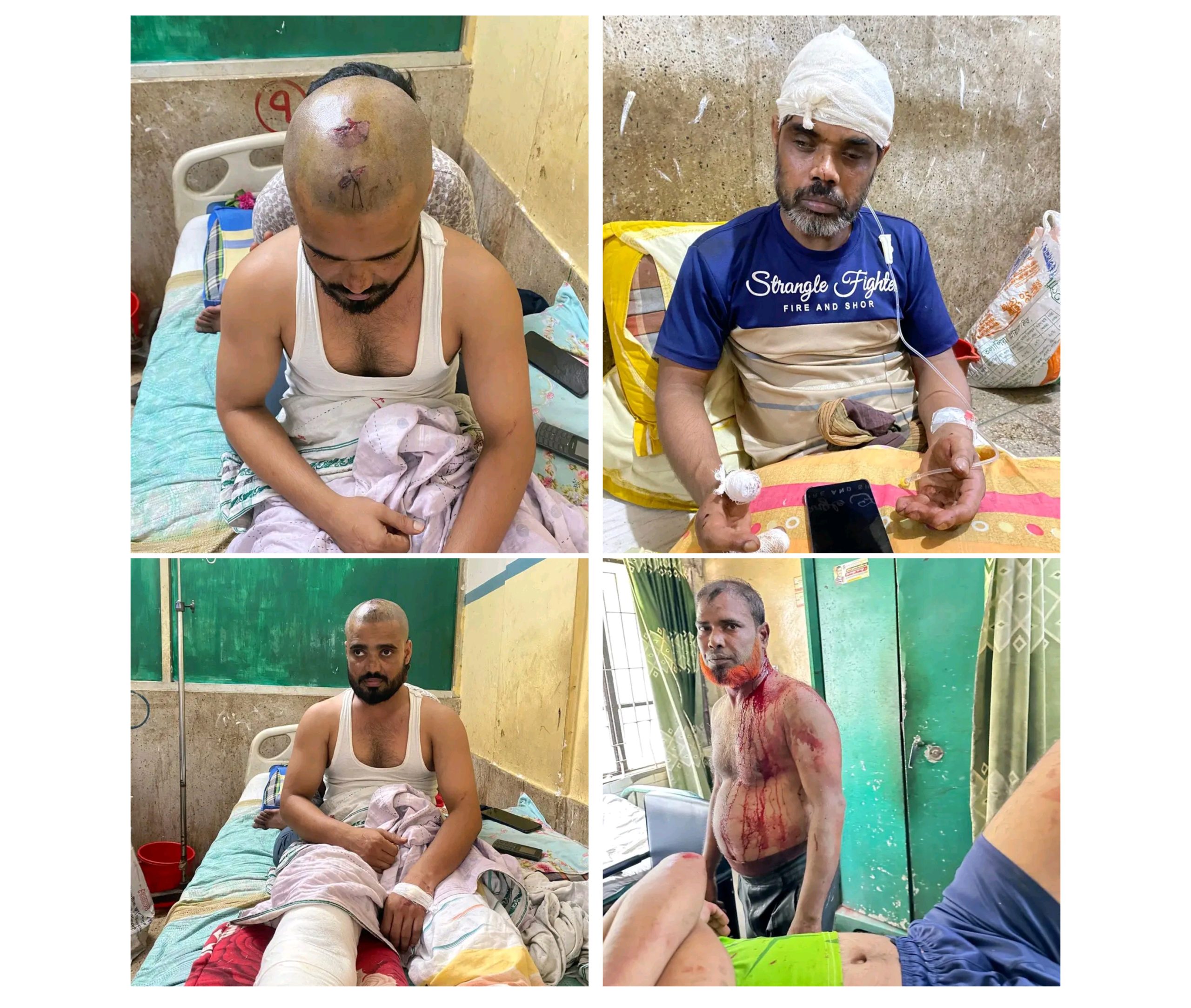 জামালপুরে সহোদর চার ভাইকে কুপিয়ে জখম করার অভিযোগ উঠেছে আওয়ামী সন্ত্রাসী হীরার বিরুদ্ধে