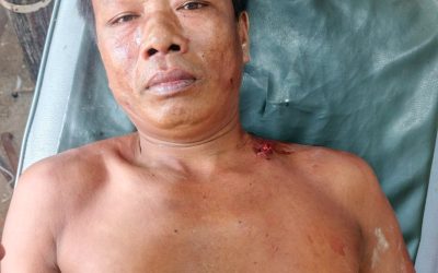 আলীকদমে জমি বিরোধে ভাইদের মারামারি, আহত একজন