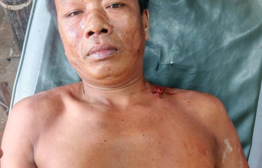 আলীকদমে জমি বিরোধে ভাইদের মারামারি, আহত একজন
