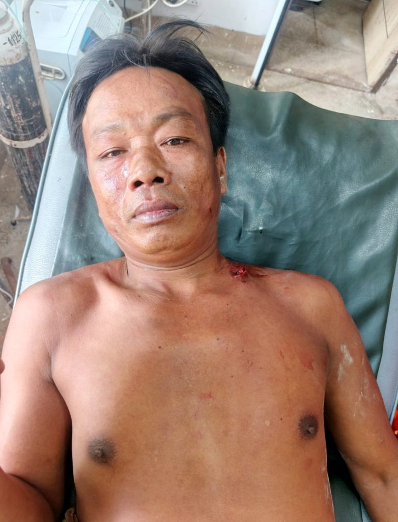 আলীকদমে জমি বিরোধে ভাইদের মারামারি, আহত একজন